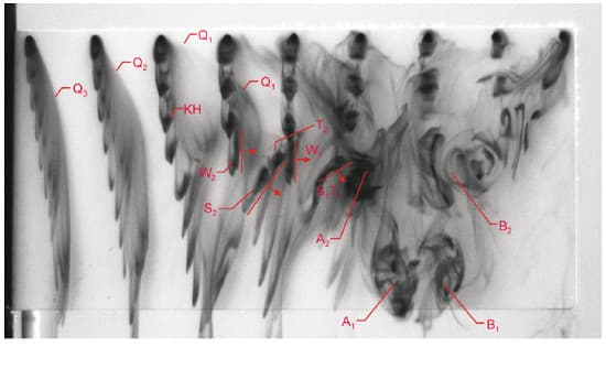 Vortical structures on a flapping wing